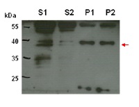 CPT6 | cis-prenyltransferase 6  in the group Antibodies Plant/Algal  / Environmental Stress / Cold stress at Agrisera AB (Antibodies for research) (AS14 2768)